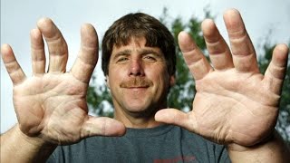 pix Largest Hands In The World