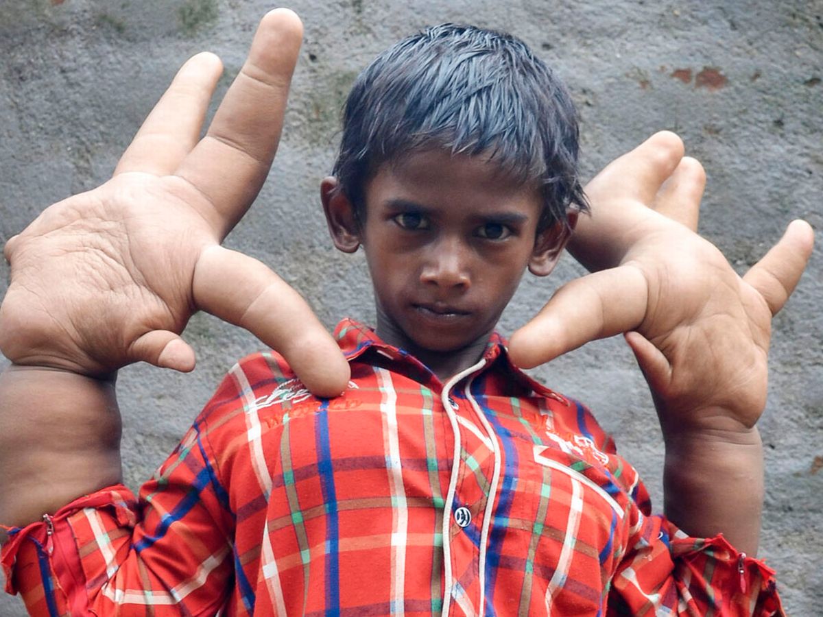 picture Largest Hands In The World