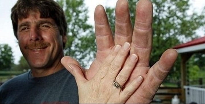 pic Largest Hands In The World