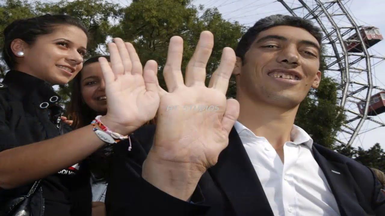 pix Who Has The Largest Hands In The World